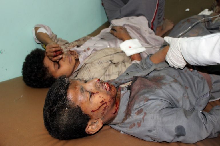 epa06937982 Wounded Yemeni children lay on a bed receiving treatment at a hospital after being injured in an alleged Saudi-led airstrike in the northern province of Saada, Yemen, 09 August 2018. According to reports, an alleged Saudi-led airstrike hit a bus carrying children in a market in the northern Yemeni province of Saada, killing at least 43 people, including children, and wounding 63 others. EPA-EFE/STRINGER
